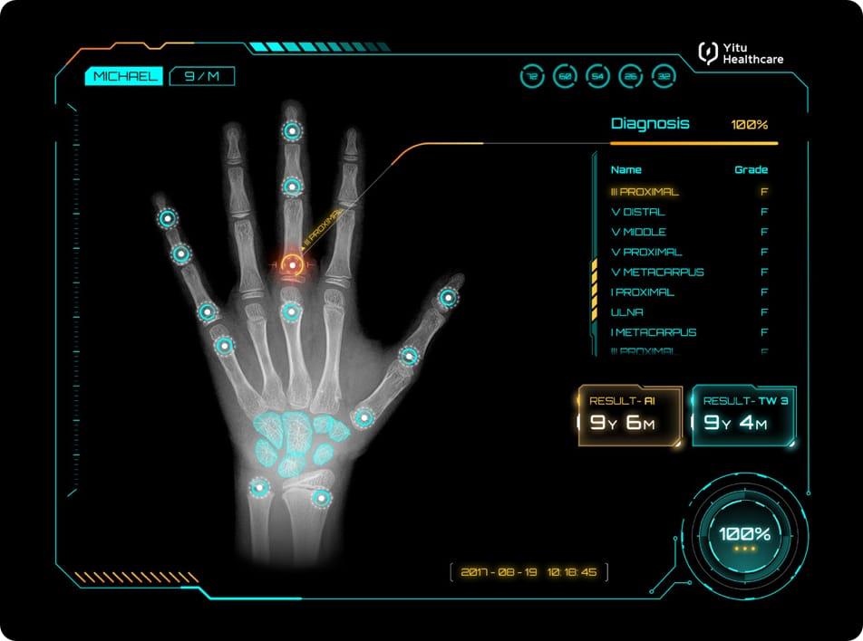 care.aiTM 兒童生長發育智能診斷系統