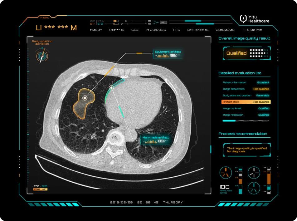 care.aiTM 智能多模態影像質控系統